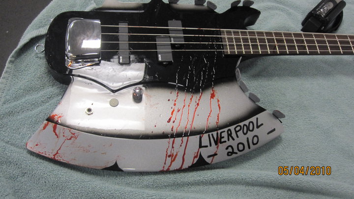 genebasliverpool